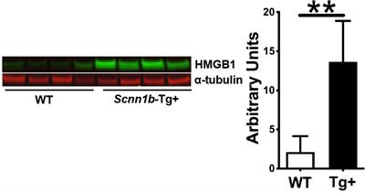 Airway epithelial cell-specific deletion of HMGB1 exaggerates inflammatory responses in mice with muco-obstructive airway disease